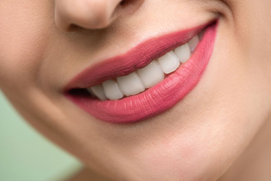 Sorriso estético com dentes alinhados e claros